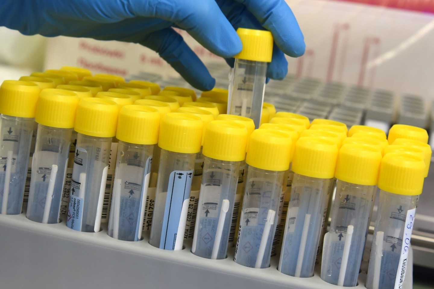 Eine medizinisch technische Laborassistentin bereitet die Bearbeitung von PCR-Tests in einem Labor vor.