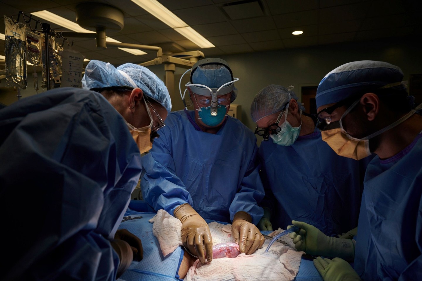 Auf diesem Foto vom September 2021, das von NYU Langone Health zur Verfügung gestellt wurde, untersucht ein Chirurgenteam in einem Krankenhaus eine Schweineniere.