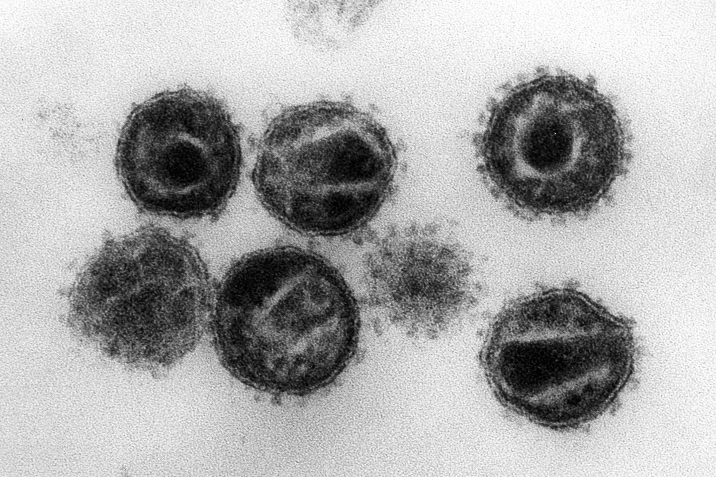 Elektronenmikroskopische Aufnahme mehrerer HIV (Humane Immunschwäche-Viren) Erreger der Immunschwäche-Krankheit Aids.